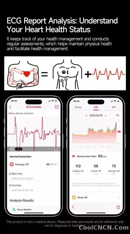 CoolWiz New Healthcare-Grade Smartwatch — Health Monitoring (Uric Acid, Lipids), ECG + PPG, Temperature, BMI, Bluetooth Calls, iOS Health smartwatch for outdoor sports and everyday use - detail