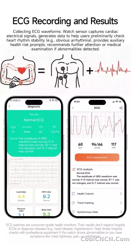 CoolWiz New Laser Therapy Smart Watch, ECG+PPG, Men’s 3D Curved Design, Sapphire Glass, Blood Pressure, Uric Acid, Lipids Monitoring, Sports smartwatch for outdoor activities and daily use - detail